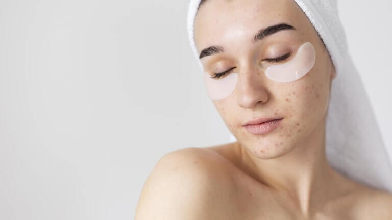 Soins du visage MD Esthétique, peau avec des imperfections.